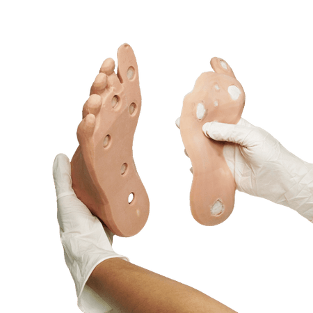 Corn and Callus debridement trainer - Medimodels